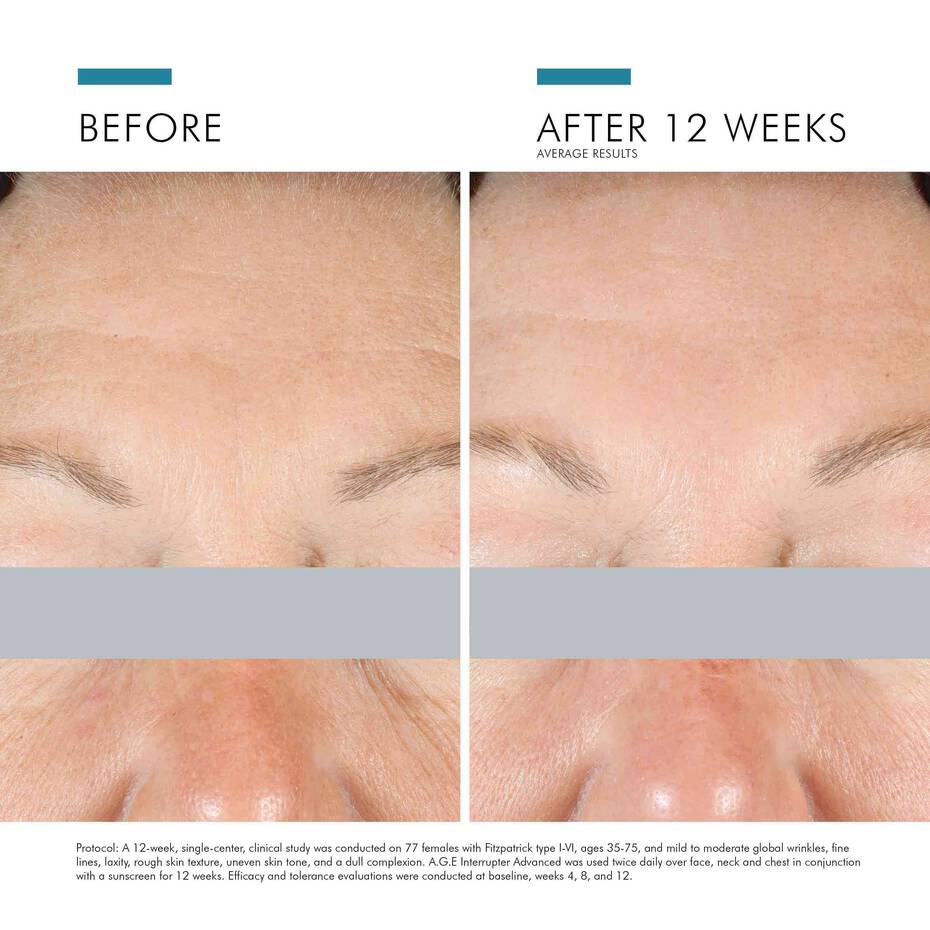 A.G.E. Interrupter Advanced 48ml | Anti-wrinkle face cream