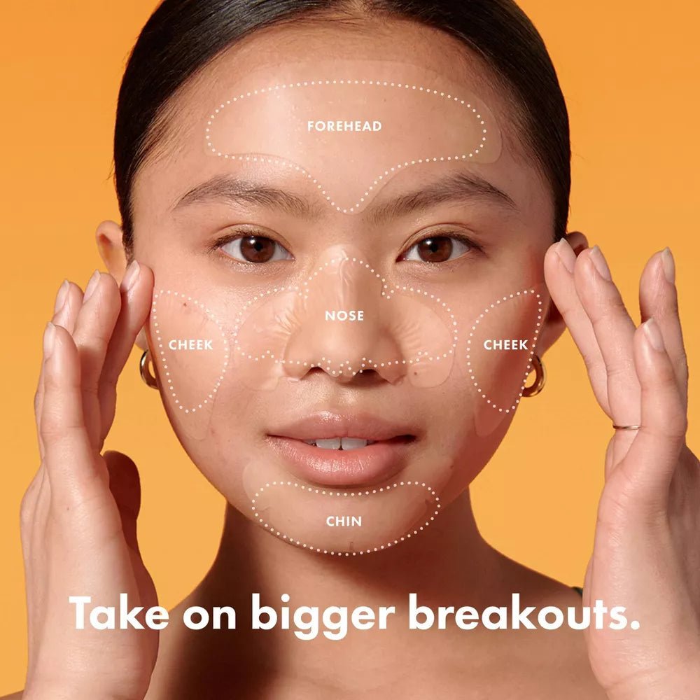 Hero Cosmetics Mighty Patch Face Patches - No Promo Code Needed!